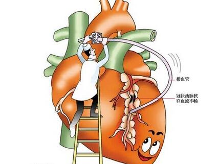 心血管疾病的心臟康復方式