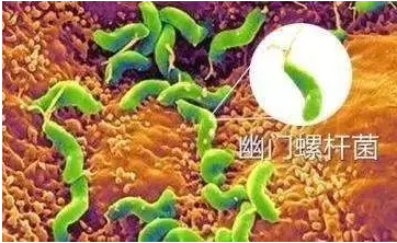 健康保險之胃癌
