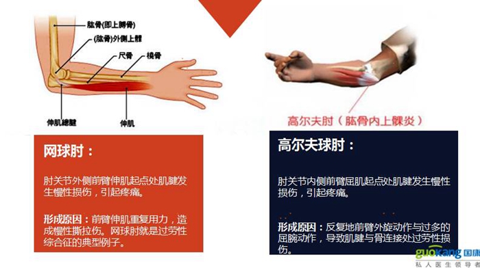 健康保險之運動損傷部位