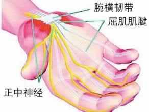 無法治愈的職業(yè)??？哭，我也在里面……告訴你鼠標手有多恐怖！