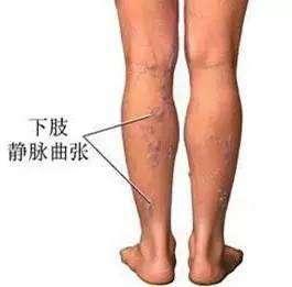 有這三種情況的人，千萬(wàn)不能用熱水泡腳！