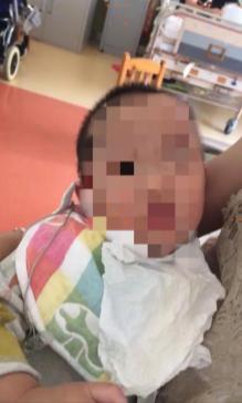 如何處理嬰幼兒發(fā)燒？這位母親的處理方式，毀了孩子的一生