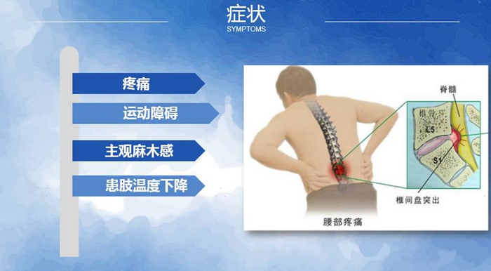 國(guó)康健康保險(xiǎn)談腰椎間盤(pán)突出