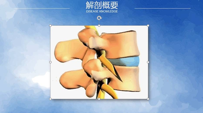 國(guó)康健康保險(xiǎn)談腰椎間盤(pán)突出
