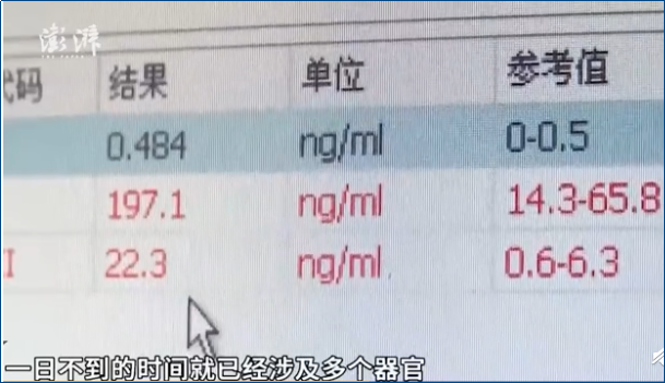 29歲女生因喝奶茶住進(jìn)ICU，喝奶茶真能引發(fā)糖尿病嗎？
